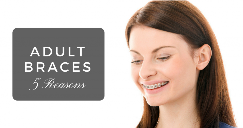 5 Reasons to Get Braces as an Adult